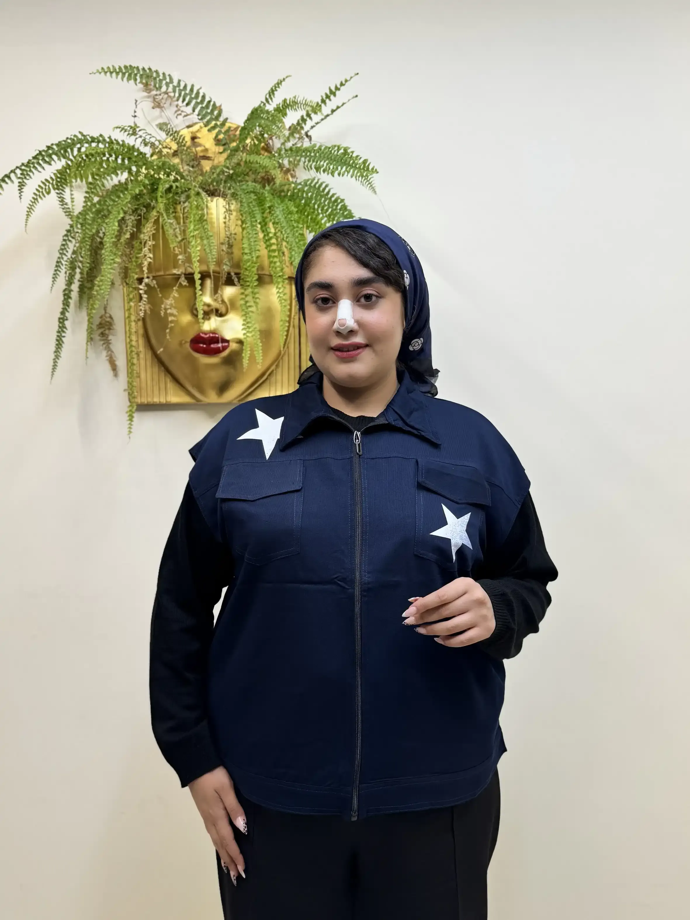 وست ستاره زیپی