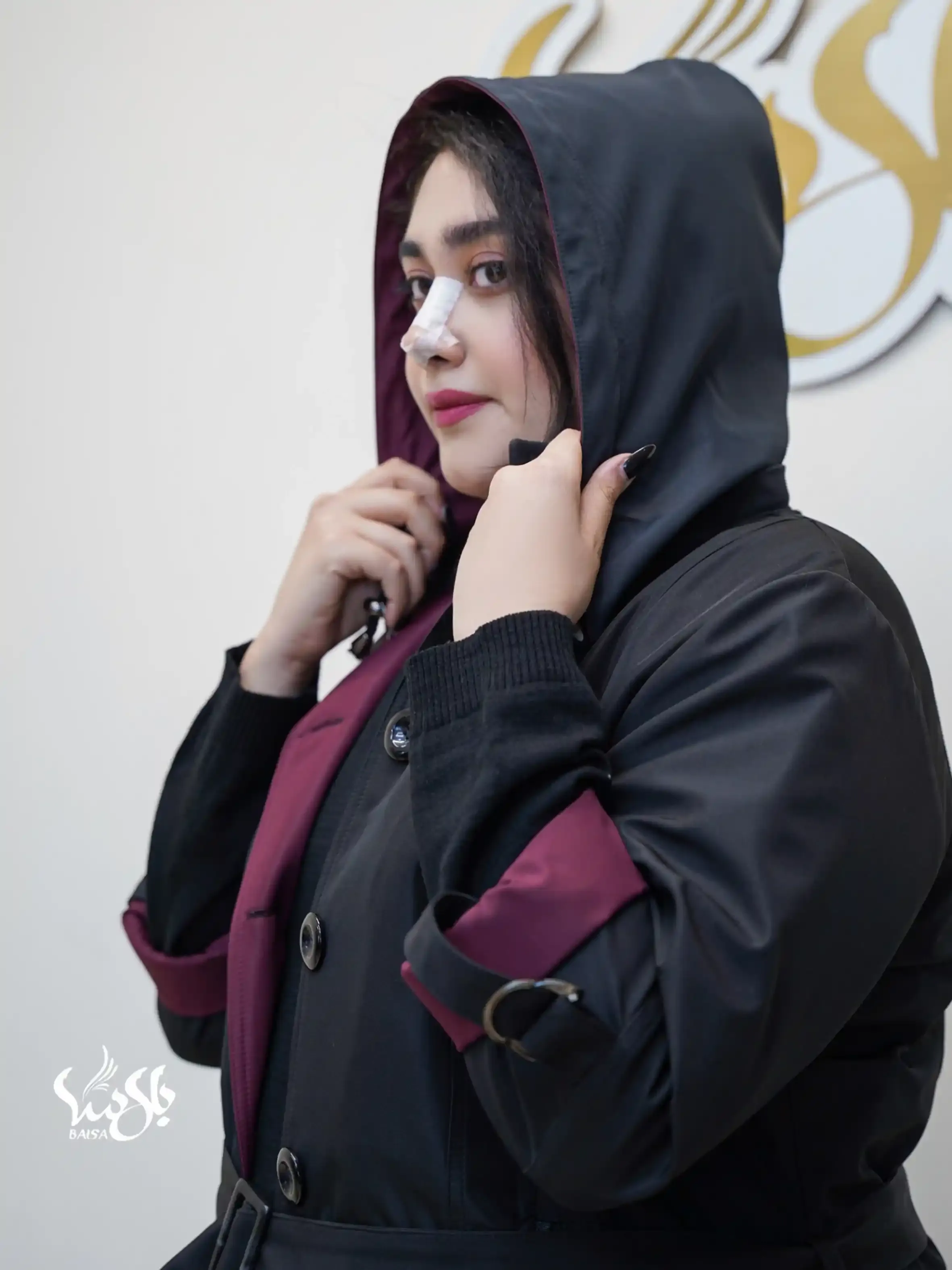 بارانی سوپر سانتانا کلاه جدا