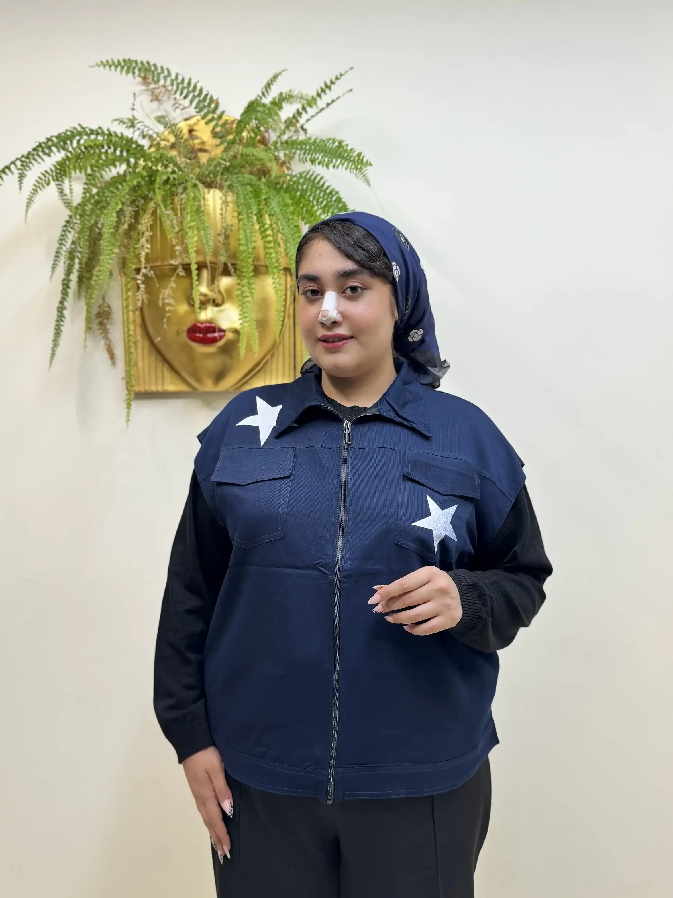 وست ستاره زیپی